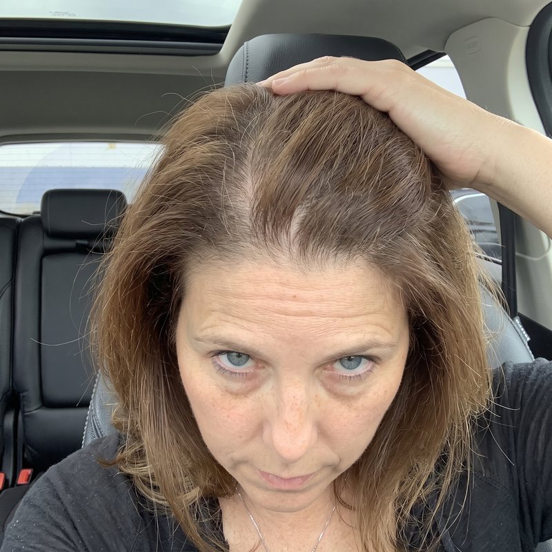 Joanne P., 45, before