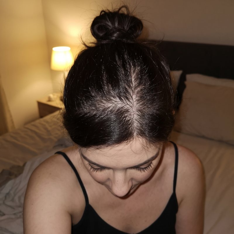 Megan L., 27, before