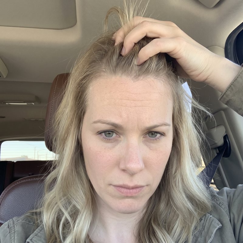 Becky S., 36, before
