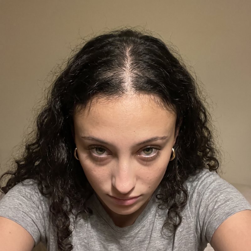 Leila A., 25, before