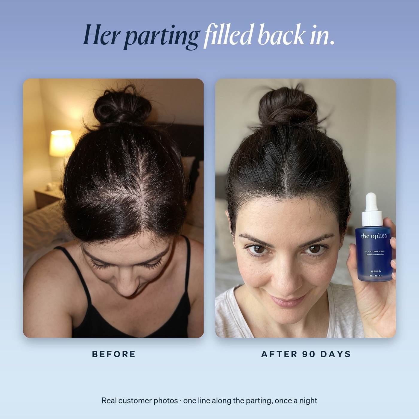 Before and after 90 days: her parting filled back in